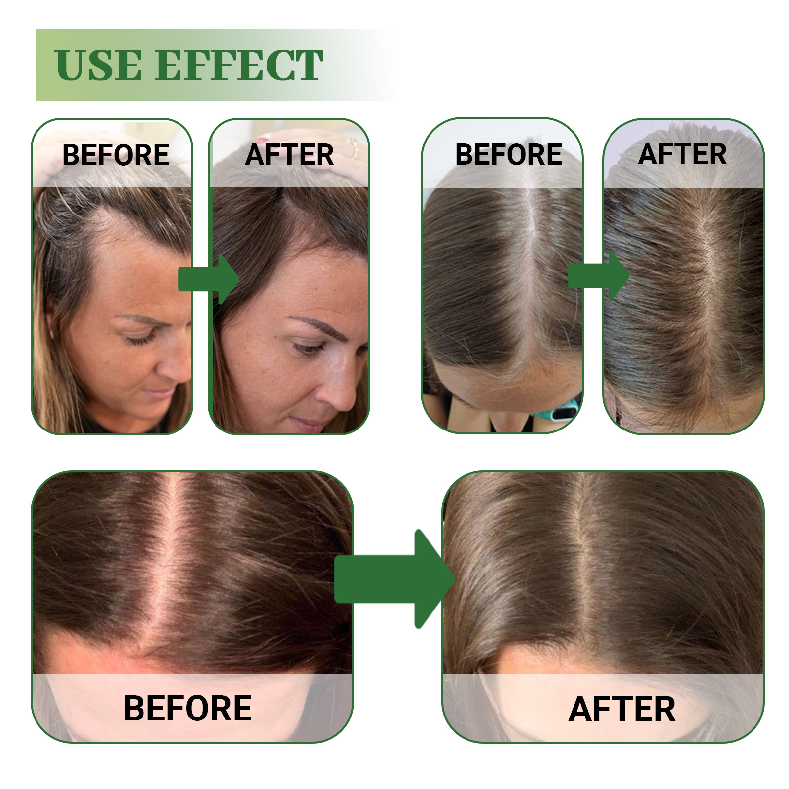 Hoegoa Rosemary Hair Repair Oi - Hair Care For Curly Dry Hair 评论和价格