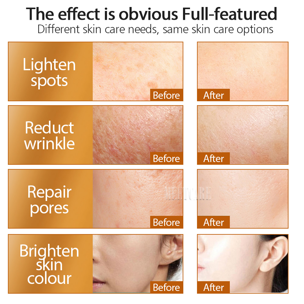 ZGTS 192pin Derma Roller Micro - Hair Care Tips 评论和价格