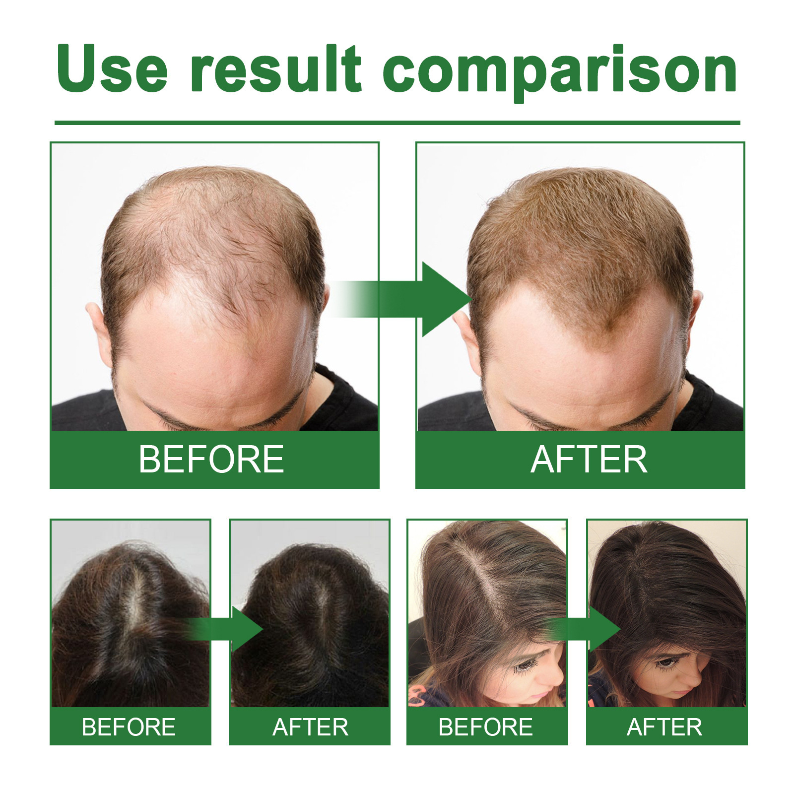 Rosemary Spray for Hair Nouris - Hair Care Natur 评论和价格